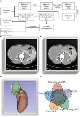 Development and validation of machine-learning models for the difficulty of retroperitoneal laparoscopic adrenalectomy based on radiomics